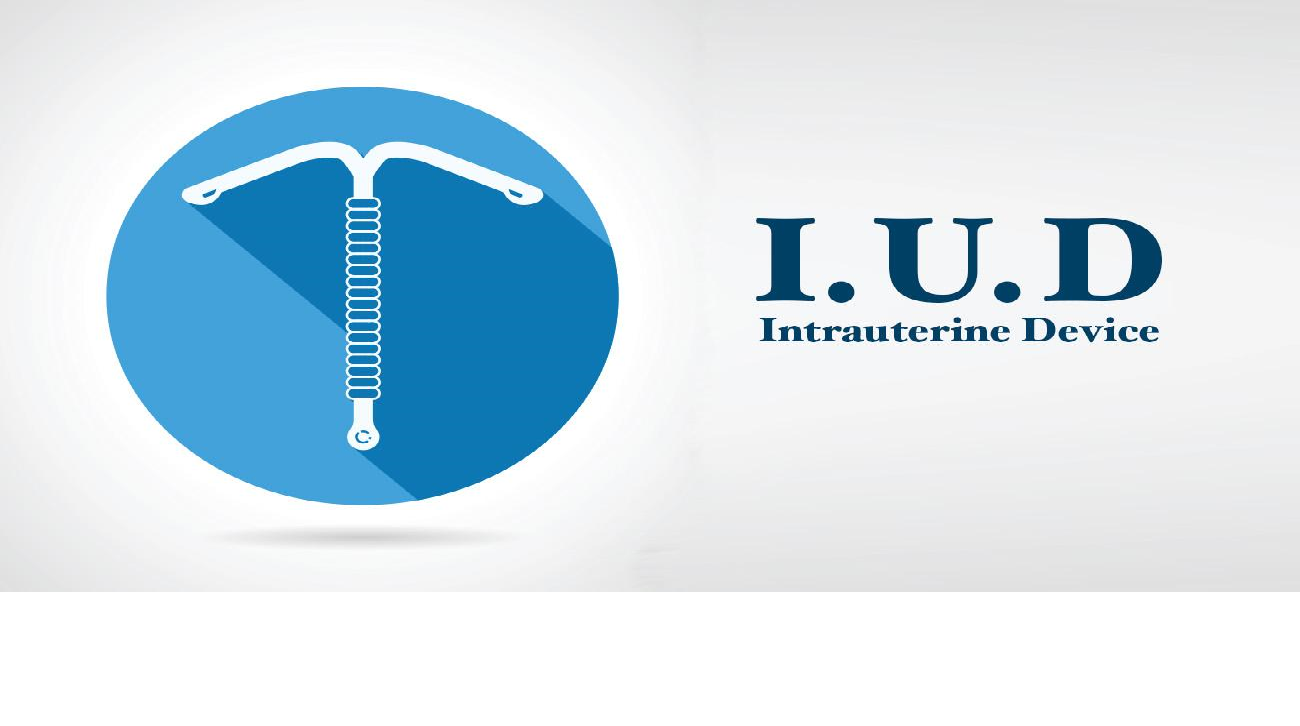 IUD Intrauterine Device