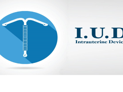 IUD Intrauterine Device